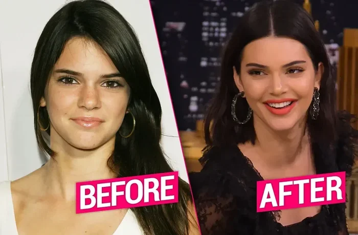 Did Toyota Jan Have Plastic Surgery Revealed Today